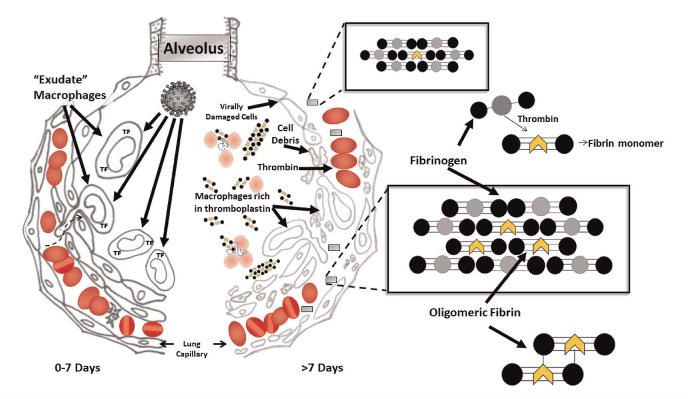Study identifies micro clots as cause of death in some severely ill